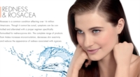 Avene Linea Trattamenti Essenziali Viso Trattamento Contorno Occhi Lenitivo 10ml